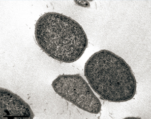 한국해양과학기술원이 심해에서 확보한 초고온성 해양 고세균 이미지